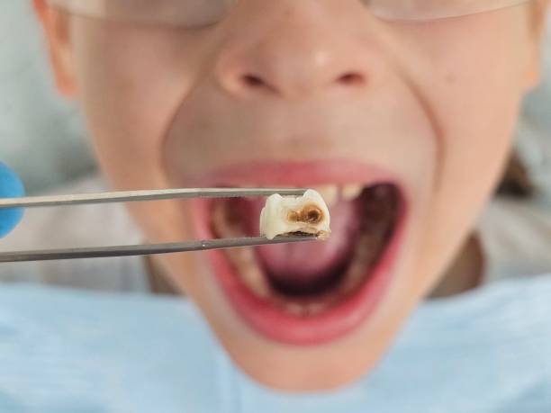 Best Tooth Infection Emergency Dentist  in Tonawanda, NY